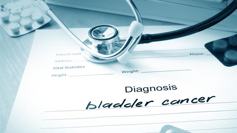 Understanding the Major Factors Contributing to Bladder Cancer Risk