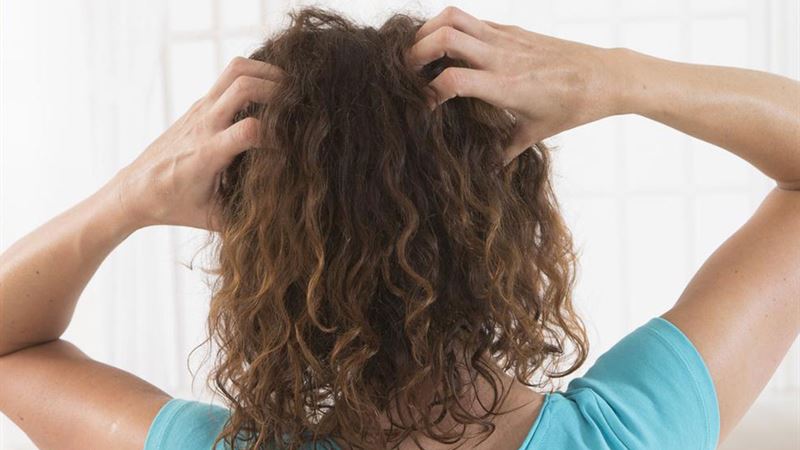 Understanding Scalp Psoriasis: Symptoms, Causes, and Effective Treatment Strategies