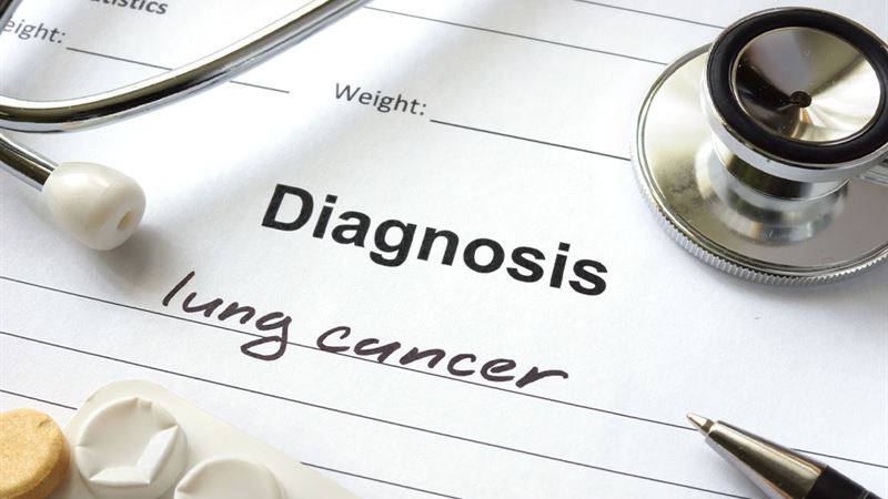 Comprehensive Guide to Lung Cancer: Types, Causes, Symptoms, and Prevention