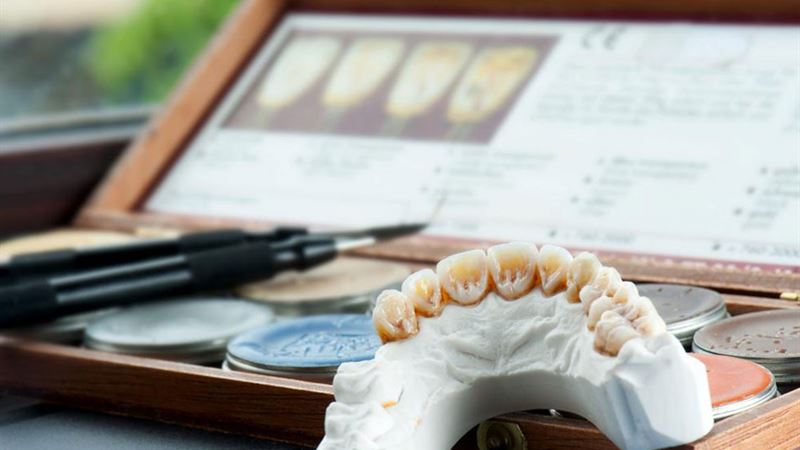 Comprehensive Guide to Dental Implant Costs and Their Advantages