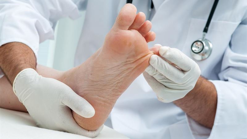 Comprehensive Guide to Effective Toenail Fungus Treatments for Rapid Recovery