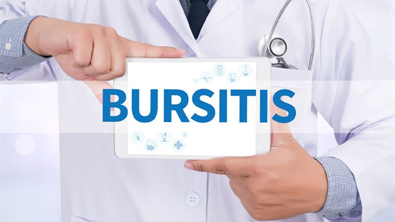Comprehensive Guide to Bursitis: Types, Symptoms, and Effective Management Strategies