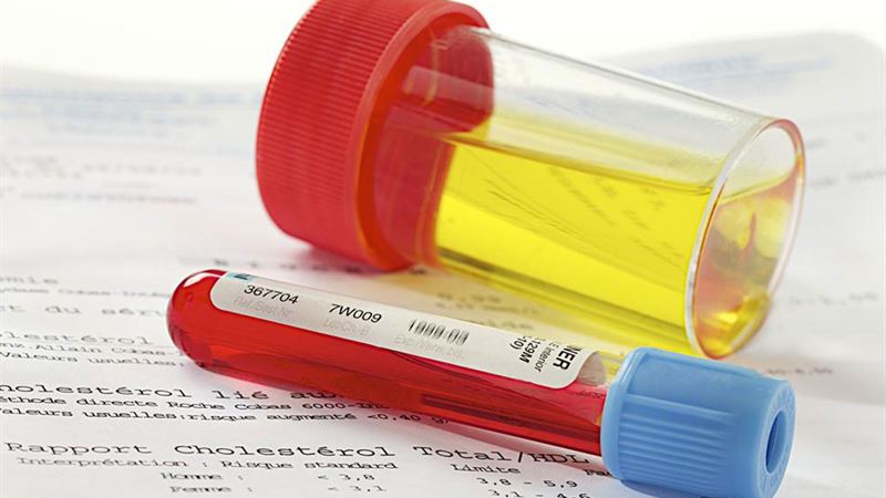 Effective Home Strategies to Heal Urinary Tract Infections Naturally