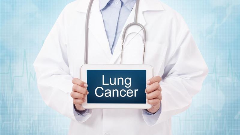 Comprehensive Strategies for Lung Cancer Management