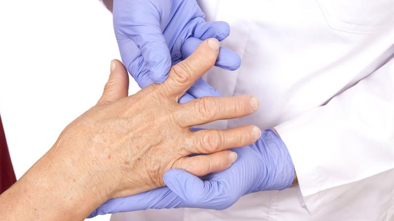 Comprehensive Guide to Different Types of Arthritis: Causes, Symptoms, and Management