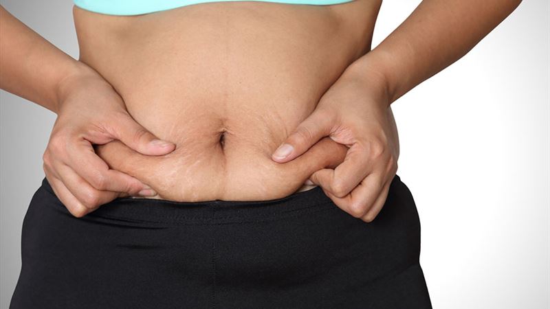 Effective Strategies for Reducing Persistent Abdominal Fat