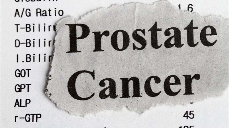 Comprehensive Guide to Prostate Cancer Stages and Management Strategies