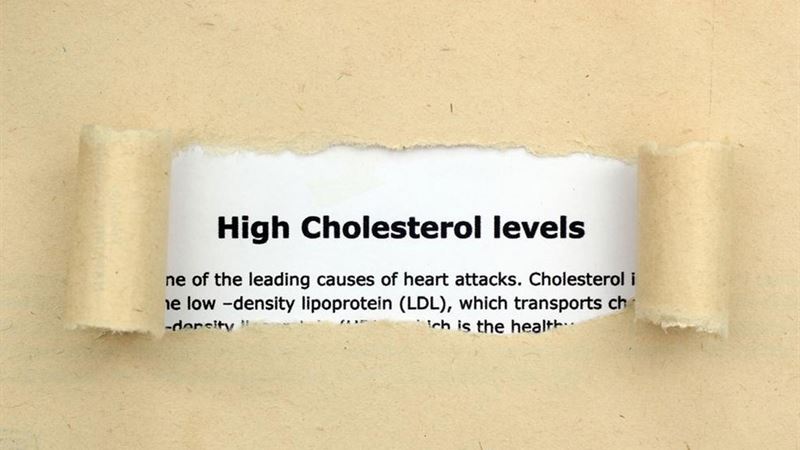 Comprehensive Guide to Managing Cholesterol for Heart Health