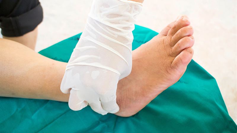 Comprehensive Guide to Recognizing Neuropathy Symptoms and Its Impact on Health