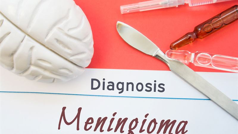 Understanding Meningioma: Symptoms, Causes, Diagnosis, and Treatment Options