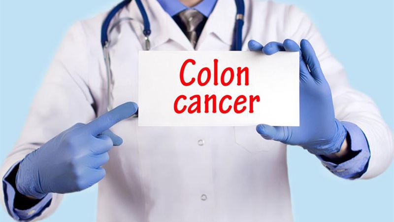 Recognizing the Key Indicators and Symptoms of Colon Cancer