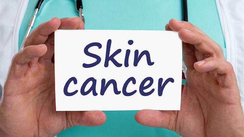 Comprehensive Guide to Skin Cancer: Types, Stages, Prevention, and More