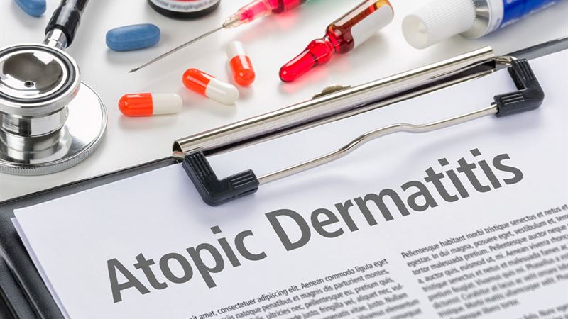 Comprehensive Strategies for the Prevention and Management of Atopic Dermatitis